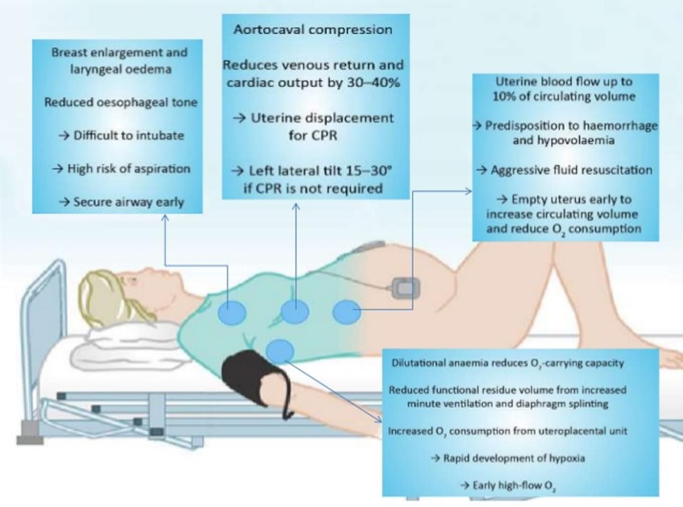 Figure from Immediate Resuscitation Following Maternal Collapse During Pregnancy