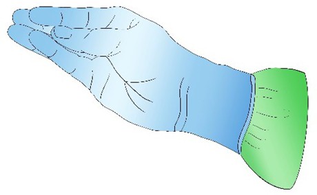 Figure from Shoulder Dystocia